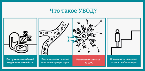 Схема УБОД